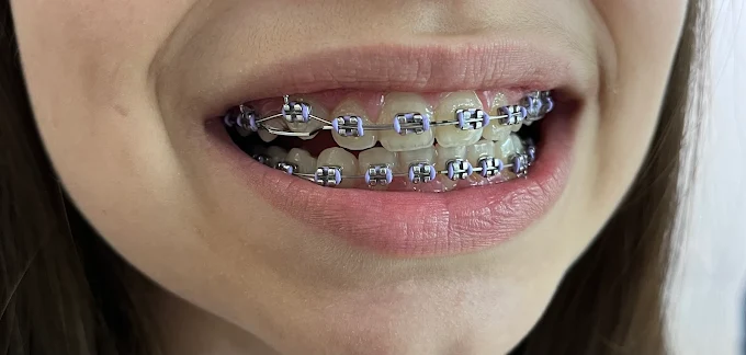 Cris Smile Studio Nasaud63